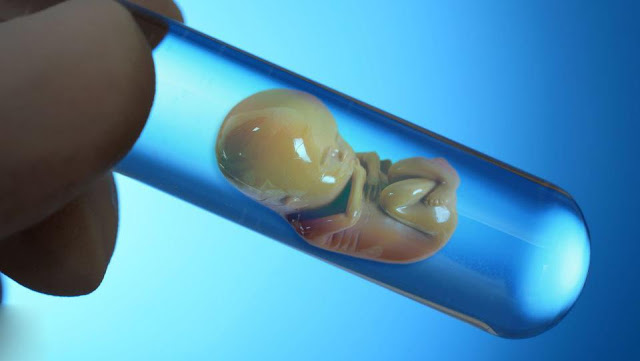 IVF – An Efficient Fertility Treatment