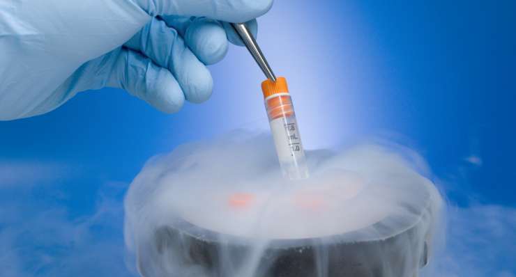 Cryopreservation