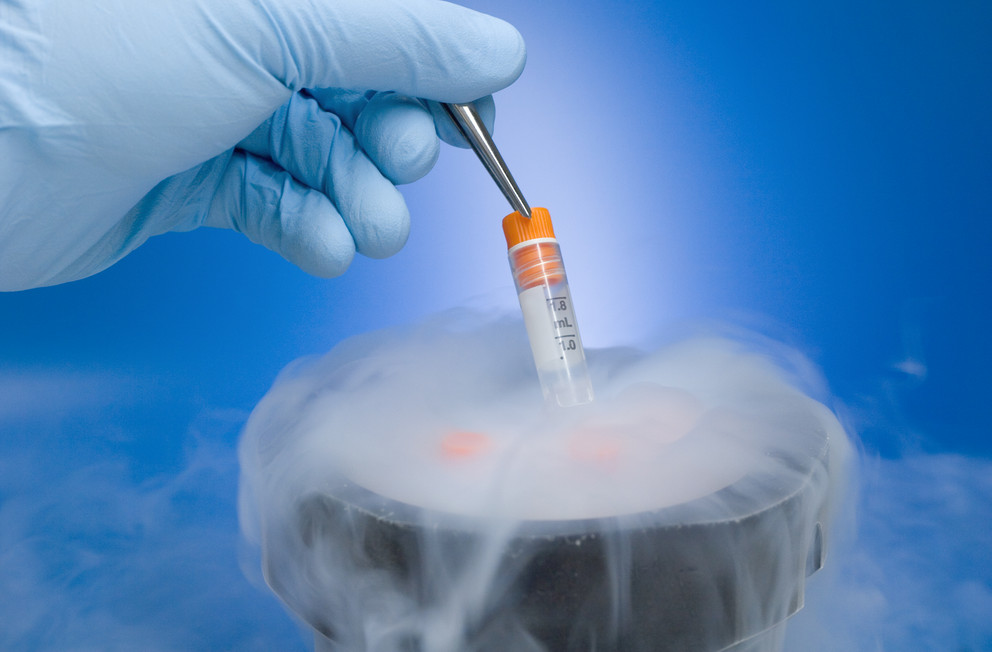 Cryopreservation